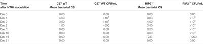 Essential Role of the Innate Immune Adaptor RIP2 in the Response to Otitis Media